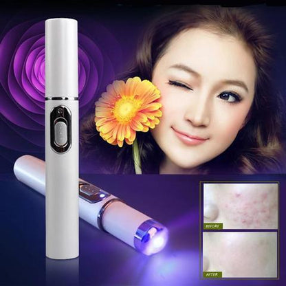 Blue Light Therapy Acne Laser Pen - N POLITICSLADY