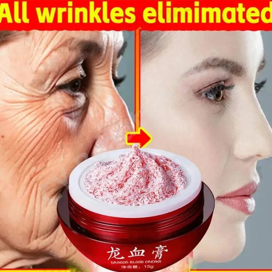 Dragon Blood Cream Wrinkle Removal Facial - 1pcs-15g POLITICSLADY